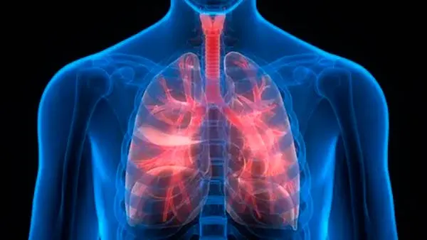 enfermedades respiratorias polvo