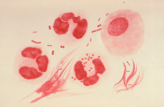 macrofagos humanos con Neisseria gonorrhoeae