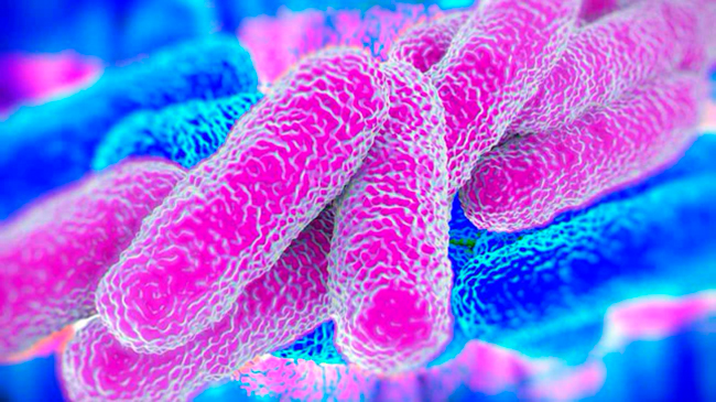 Legionella pneumophila