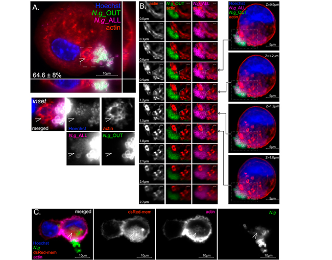 Figura 4 colonizacion de macrofagos humanos por Neisseria gonorrhoeae